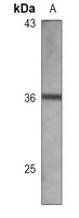 FGFR4 Antibody
