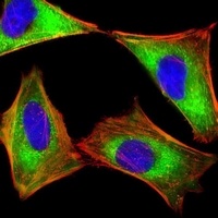 PKR Mouse Monoclonal Antibody