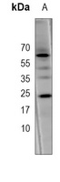 VEGFR1 Mouse Monoclonal Antibody