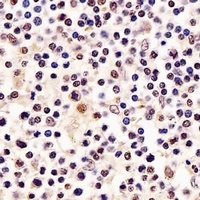 RPA2 Mouse Monoclonal Antibody