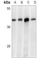MTHFD2 Mouse Monoclonal Antibody