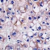 E Cadherin Mouse Monoclonal Antibody