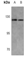 E Cadherin Mouse Monoclonal Antibody