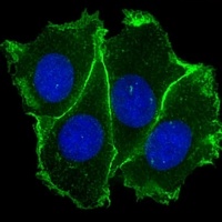 E Cadherin Mouse Monoclonal Antibody