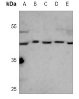 Creatine Kinase B Mouse Monoclonal Antibody