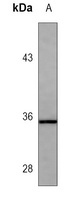 CD20 Antibody