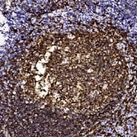 CD20 Antibody