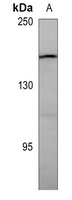 PDGFR beta Mouse Monoclonal Antibody