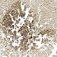 Gamma-enolase Antibody [KO/KD Validated]
