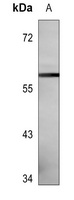 Vimentin Mouse Monoclonal Antibody