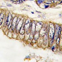 c-Met Mouse Monoclonal Antibody