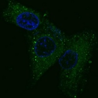 c-Met Mouse Monoclonal Antibody