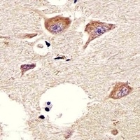 CHRM2 Mouse Monoclonal Antibody