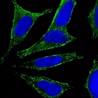 CHRM2 Mouse Monoclonal Antibody