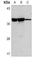 ERCC1 Mouse Monoclonal Antibody