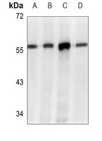 PDI Mouse Monoclonal Antibody