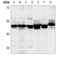 Alpha-enolase Antibody