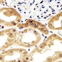 Alpha-enolase Antibody