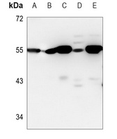 p53 Mouse Monoclonal Antibody