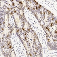 p53 Mouse Monoclonal Antibody
