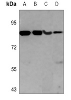 Glucocorticoid Receptor Mouse Monoclonal Antibody
