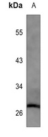 BCL10 Mouse Monoclonal Antibody