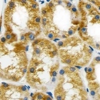 BCL10 Mouse Monoclonal Antibody