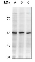 IKK beta Mouse Monoclonal Antibody