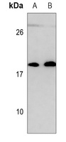 UBE2C Mouse Monoclonal Antibody