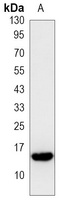 Histone H2A.X (Phospho-S139) Antibody