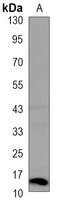 Histone H2A.X (Phospho-S139) Antibody
