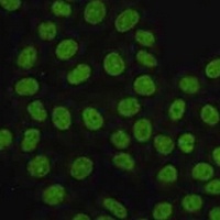 PCNA Antibody