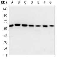 Histone Deacetylase 2 Mouse Monoclonal Antibody