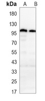 CD54 Mouse Monoclonal Antibody