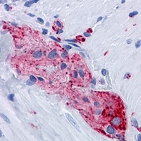 Synaptophysin Antibody