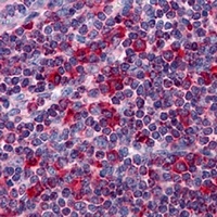 Metadherin Mouse Monoclonal Antibody