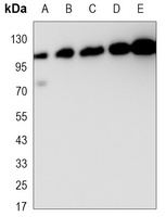 EPHB1 Mouse Monoclonal Antibody