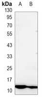 S100-A4 Antibody