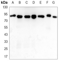STAT5A Mouse Monoclonal Antibody