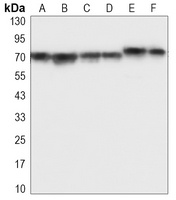 IGF2BP3 Antibody