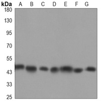 Histone Deacetylase 3 Mouse Monoclonal Antibody