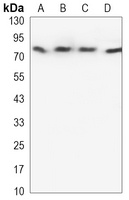 BTK Mouse Monoclonal Antibody