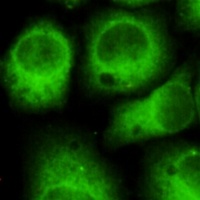 CDK5 Mouse Monoclonal Antibody