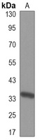 Cyclin D2 Mouse Monoclonal Antibody