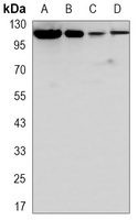 ACLY Mouse Monoclonal Antibody