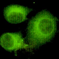 ACLY Mouse Monoclonal Antibody