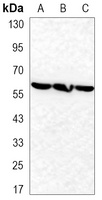 TBL1XR1 Antibody