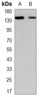 TIF1 gamma Mouse Monoclonal Antibody