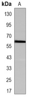 SMYD1 Antibody