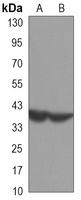 PRMT6 Mouse Monoclonal Antibody